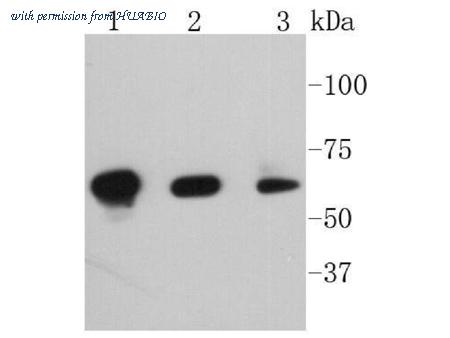 HUABIO ET1608-58 image 1