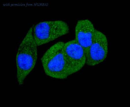 HUABIO ET1608-58 image 2