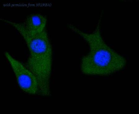 HUABIO ET1608-58 image 3