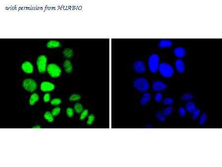 HUABIO ET1608-61 image 3