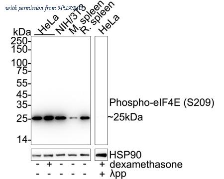 HUABIO ET1608-66 image 1