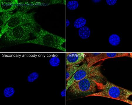 HUABIO ET1608-66 image 2