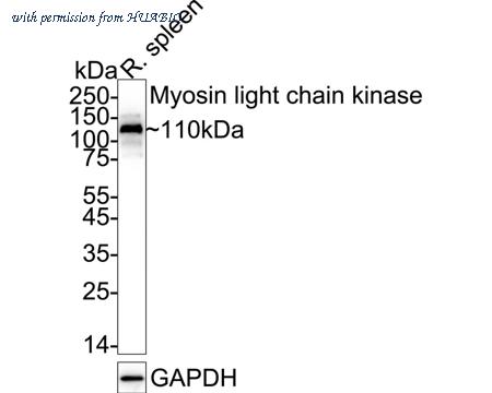HUABIO ET1608-68 image 1