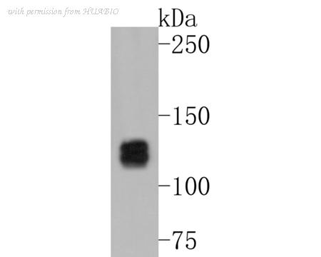 HUABIO ET1608-68 image 2