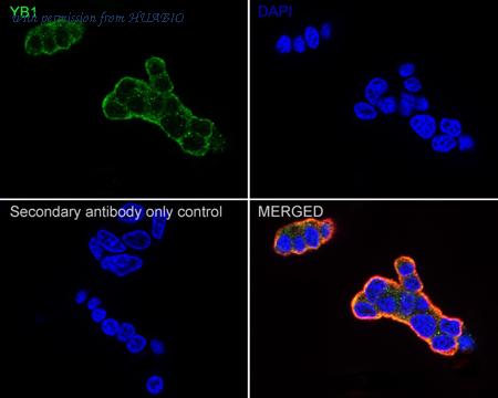 HUABIO ET1609-10 image 2
