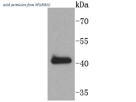 HUABIO ET1609-11 image 1