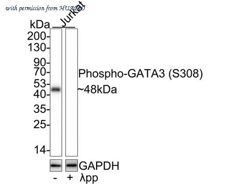HUABIO ET1609-17 image 1