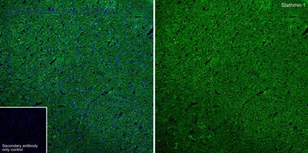 HUABIO ET1609-20 image 1