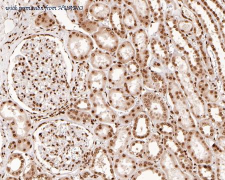 HUABIO ET1609-23 image 2