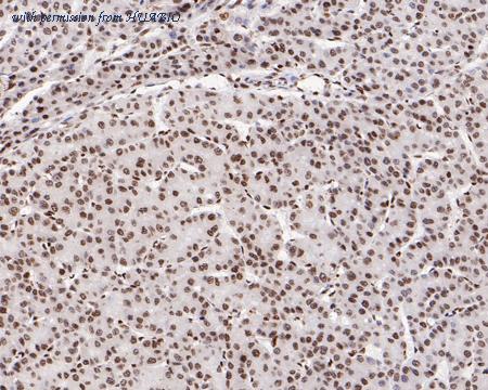 HUABIO ET1609-23 image 3