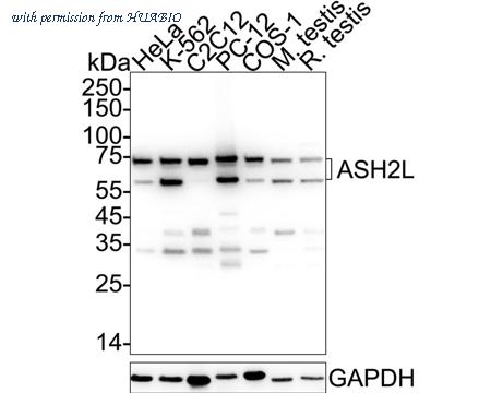 HUABIO ET1609-24 image 1