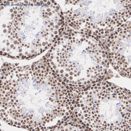 HUABIO ET1609-24 image 3