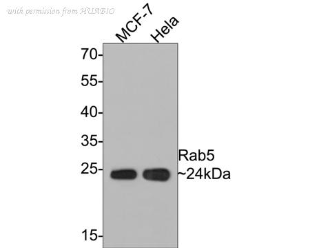 HUABIO ET1609-27 image 2