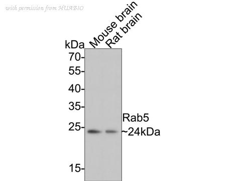 HUABIO ET1609-27 image 3
