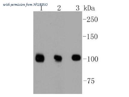 HUABIO ET1609-32 image 1