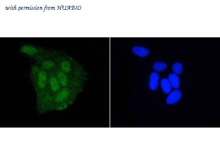 HUABIO ET1609-32 image 2