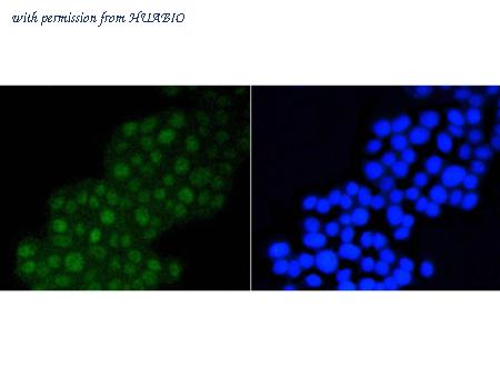 HUABIO ET1609-32 image 3