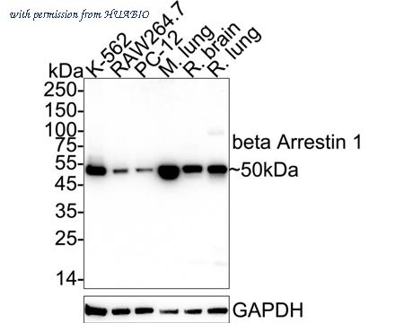 HUABIO ET1609-38 image 1