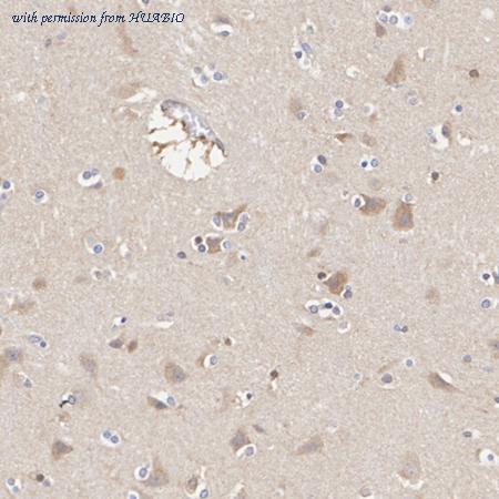 HUABIO ET1609-38 image 2