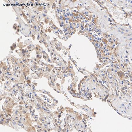 HUABIO ET1609-38 image 3