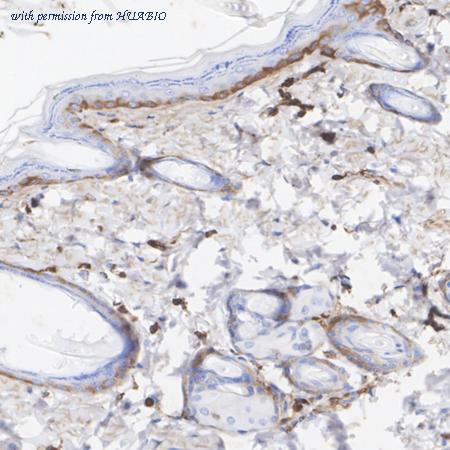 HUABIO ET1609-39 image 3