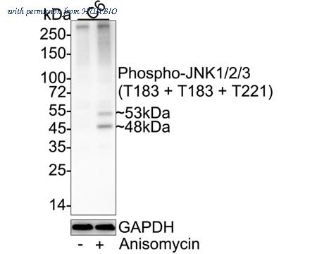 HUABIO ET1609-42 image 2