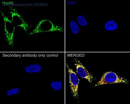 HUABIO ET1609-45-50UL image 2