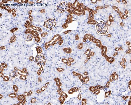 HUABIO ET1609-48 image 2