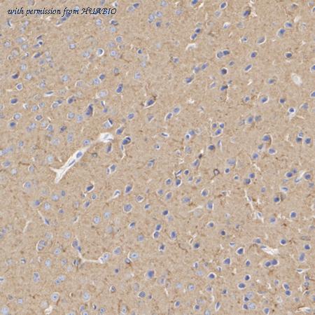 HUABIO ET1609-48 image 3