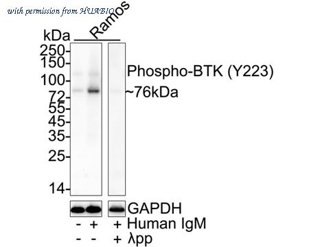 HUABIO ET1609-55 image 1