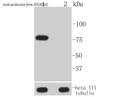 HUABIO ET1609-55 image 2