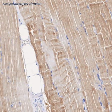 HUABIO ET1609-61 image 2