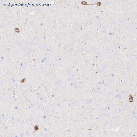 HUABIO ET1609-61 image 3