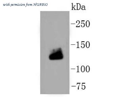 HUABIO ET1609-68-50UL image 1