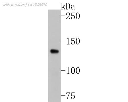 HUABIO ET1609-68-50UL image 2