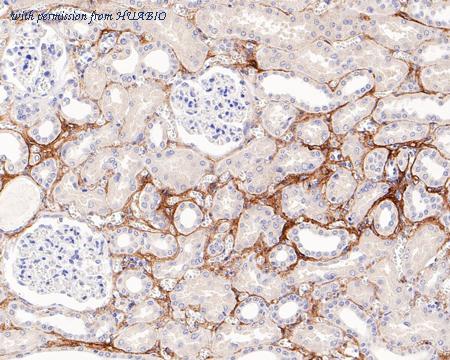 HUABIO ET1609-68-50UL image 3