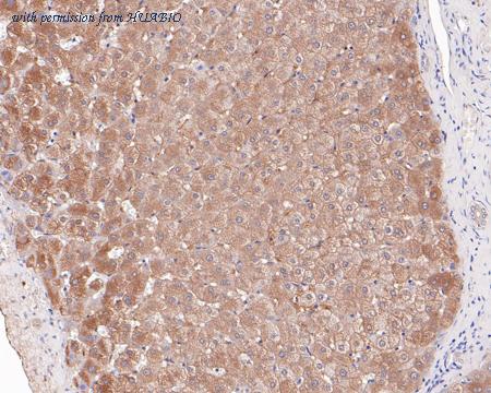 HUABIO ET1609-69-50UL image 2