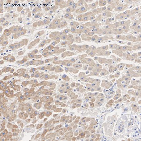 HUABIO ET1609-73 image 3