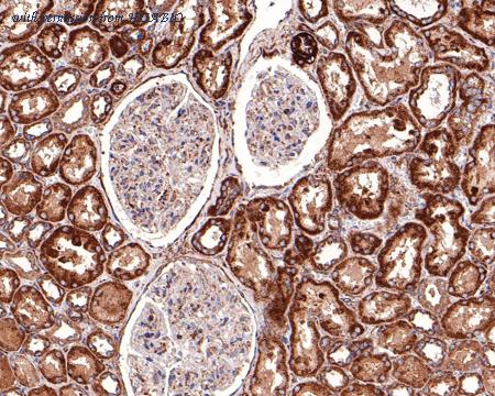 HUABIO ET1609-77 image 3