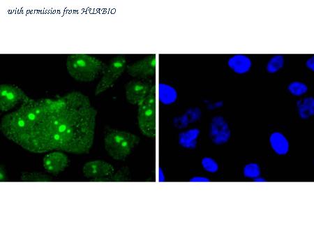 HUABIO ET1609-8 image 3