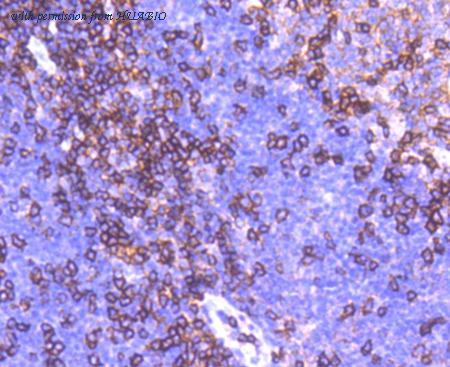 HUABIO ET1610-1 image 3