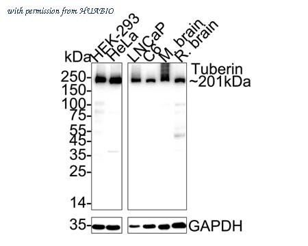 HUABIO ET1610-10 image 1