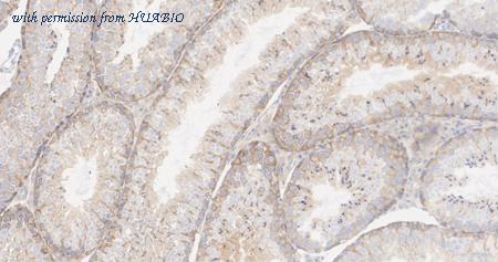 HUABIO ET1610-10 image 3