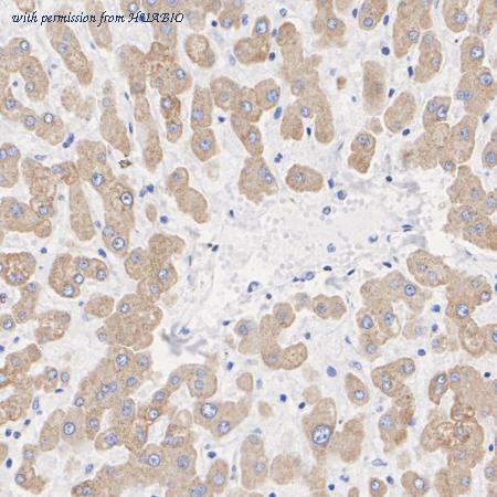 HUABIO ET1610-16 image 3