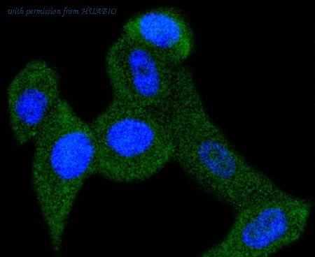 HUABIO ET1610-18 image 3