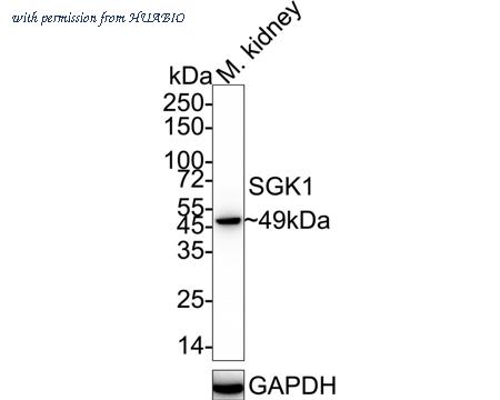 HUABIO ET1610-19 image 1