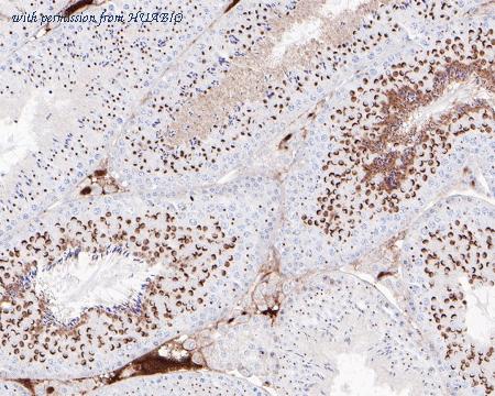 HUABIO ET1610-2 image 2