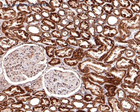 HUABIO ET1610-20 image 3