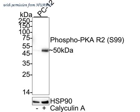 HUABIO ET1610-29 image 1