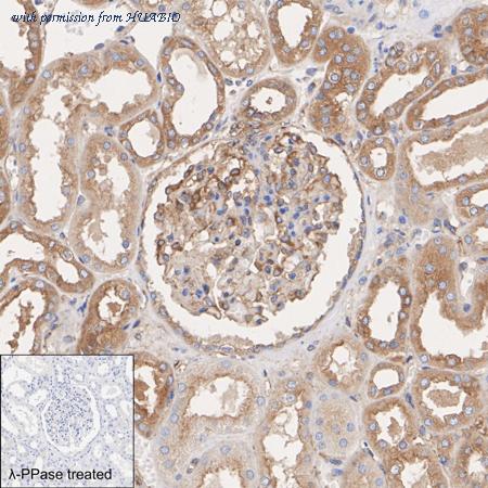 HUABIO ET1610-29 image 2